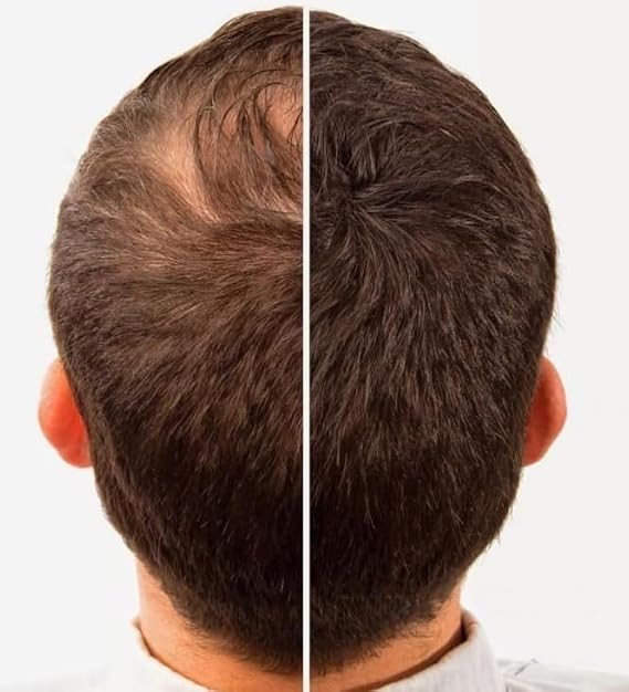 Hair Building Fibers 100% Wool - Natural Keratin. Compatible with Leading Brands Size: 1/2 a Pound (227Grams) Bulk Refill Pack 60-80% SAVINGS.. (Dark Blond, 227 grams)