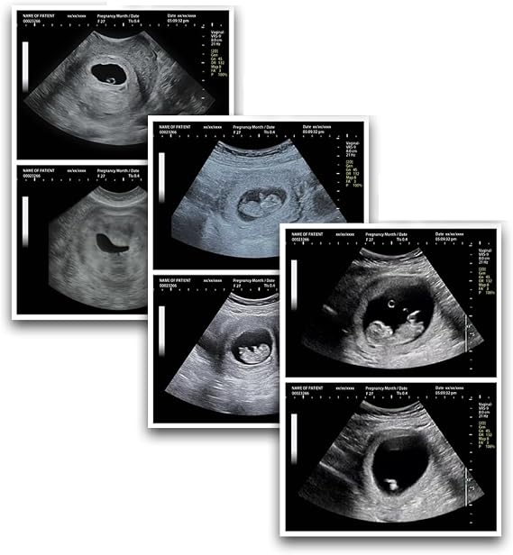 Custom Fake Ultrasound | Personalized Fake Pregnancy Ultrasound | Realistic Fake Sonogram | Fake Ultrasound Twins | Fun Prank Pregnancy Test Gift
