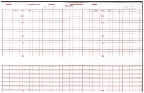 Corometrics Fetal Monitoring Paper 4483AAO, 150 Sheets - 10 pckgs.